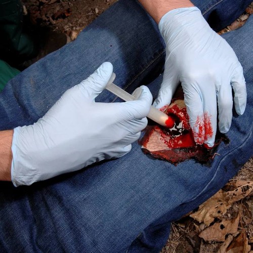 Аппликатор гемостатический с гранулами Rhino Rescue в Арзамасе хитозановый