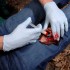 Аппликатор гемостатический с гранулами Rhino Rescue в Арзамасе хитозановый